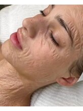 ビジュー(Bijoux)/シワ・たるみケアに♪