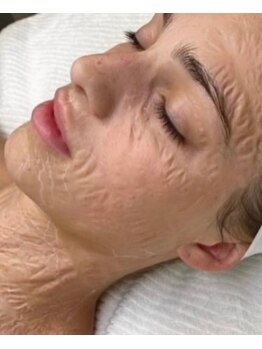 ビジュー(Bijoux)/シワ・たるみケアに♪