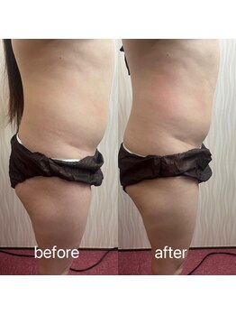 ヤン リン 整体(Yang Ling 整体)/お腹ケア