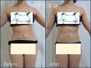 ボンボン(BONBON)/施術　ボディ全身