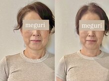 メグリ(meguri)の雰囲気（美容整骨との組み合わせで、バランスの良い小顔へ。）