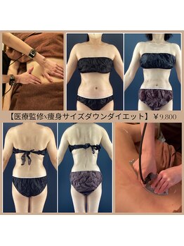 ラ ミュー エステハウス 松阪店/見た目-10kg♪全身サイズダウン