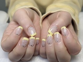 持ち込みレースイエローフレンチ