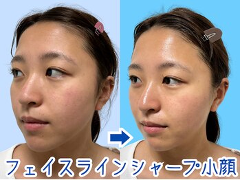 ナチュラルビューティーフェイス 横浜(NBF)/歪みは整う！/横浜市小顔矯正