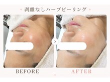 パールプラス 伊勢店(Pearl plus)/ツボ押しで小顔/リラックス効果