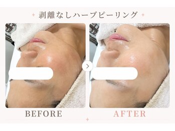 パールプラス 伊勢店(Pearl plus)/ツボ押しで小顔/リラックス効果