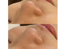 シーズ(C'ies)の雰囲気（ハーブピーリングで肌質改善◎ニキビ・くすみ・毛穴ケア・ニキビ）