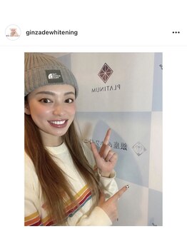 銀座deホワイトニング　/【有名人、モデルも多数ご来店】