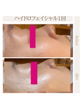 ポムポムボナー/ハリ/ツヤ/きめ/毛穴改善♪