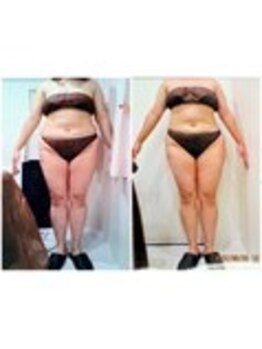 パーフェクトボディプレミアム 渋谷店(PERFECT BODY PREMIUM)/お客様 ビフォーアフター(25)