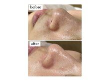 フリュ(Flux)の雰囲気（フェイシャルメニューは漢方蒸しと合わせることで効果アップ）