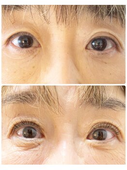 チアアップ 練馬(Cheer up)/まつげパーマ／アイリッドアップ