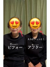 整体院りょう 高槻市/#むくみ エラ改善