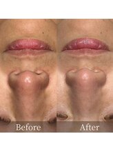 インフィニーズ(INFINEEZ)/カスタマイズ120分美肌改善50代