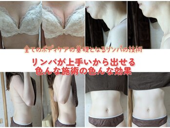 スノードロップ(snowdrop)