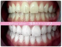 エクシアホワイトニング 西条店/