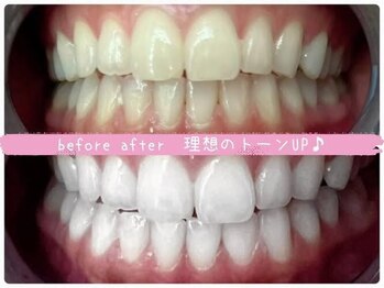 エクシアホワイトニング 西条店/