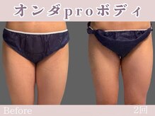 レッド(RED)/マイクロウェーブpro