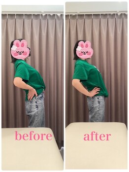 いおり骨盤整体 リブート(RE:BOOT)/姿勢矯正ビフォーアフター