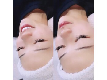 グリーム(GLEAM)/大人気★フェイシャルメニュー