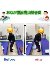おなが浦添当山整体院/腰痛、可動域改善！
