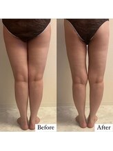 フェミニー(Feminy)/クッキリ隙間登場