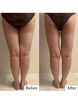 フェミニー(Feminy)/クッキリ隙間登場