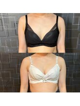 ジュリア(JULIA)/【バストアップ/育乳　症例】