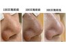 【黒ずみ皮脂詰まり解消！ツルツル肌に】毛穴美肌コース70分¥12000→¥9000