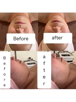 クレマチス/新メニュー『レモンボトル』