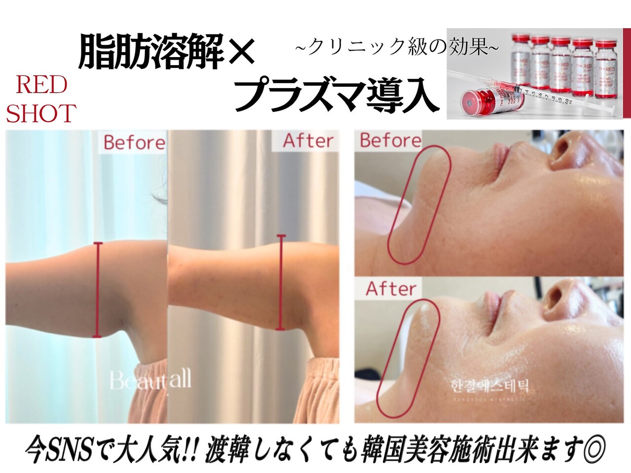 リーインカーナ アーティスト(REINCARNA ARTIST