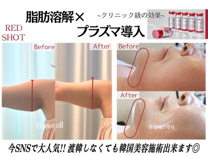 リーインカーナ アーティスト(REINCARNA ARTIST)の写真