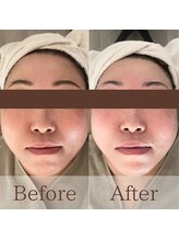 凪眠/小顔リンパフェイシャルの効果82