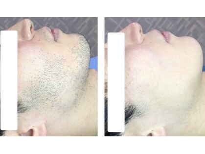 チャームプラス(CHARM+)の写真