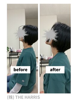 由利本荘整体院/施術ビフォーアフター（首）