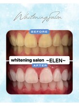 エレン 高槻店(ELEN)/ モテ度、好感度、清潔感UP！