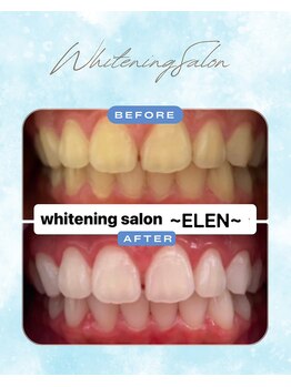 エレン 高槻店(ELEN)/ モテ度、好感度、清潔感UP!