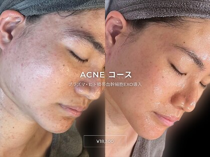 キュレイテッドスキン(CURATED SKIN)の写真