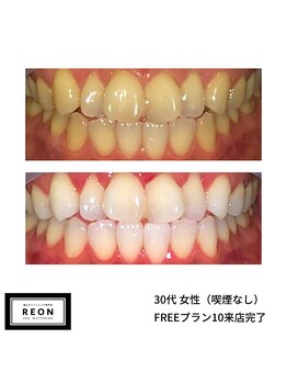 レオン 磐田(REON)/◇ お客様 before＆after ◇