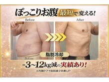 サロンドモモ(SALON de MOMO)