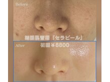 サロン エム(saron M)