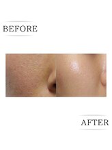 ココ(COCO)/お客様ビフォーアフター