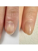 ジル(JiLL)/【自爪育成】