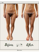 ドゥ ドルチェ(Due dolce)/まっすぐとしたスラリ足　1回