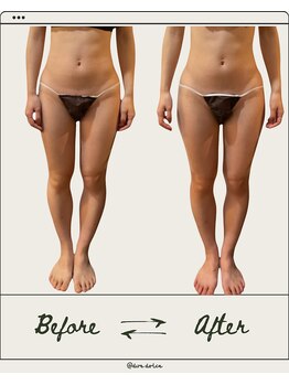 ドゥ ドルチェ(Due dolce)/まっすぐとしたスラリ足　1回