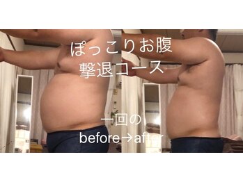 ナナラ(nanala)/ポッコリお腹撃退コース