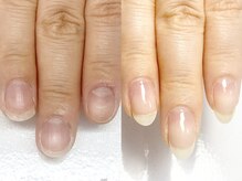 ティティーネイル(titynail)の雰囲気（[自爪育成]爪の形を良くしたい、綺麗に爪を伸ばしたい方へ）