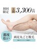 めんどくさい自己処理卒業！両足丸ごと脱毛　¥3,300
