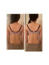 美人バスト 表参道店/体験◆初回バストアップ症例