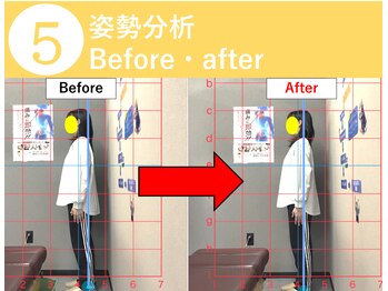 おざき鍼灸接骨院 高茶屋院/【流れ5】ビフォーアフター確認